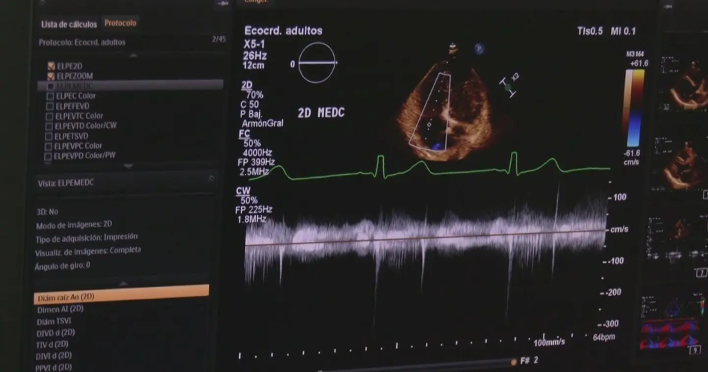 Enfermedades del corazón, principal causa de muerte en México