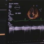Enfermedades del corazón, principal causa de muerte en México