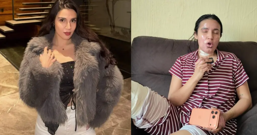 Actriz mexicana sobrevive a explosión en su domicilio