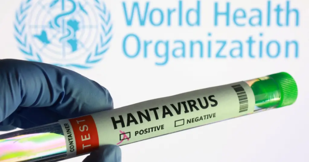 Nuevo caso de hantavirus genera preocupación sanitaria; autoridades mantienen vigilancia epidemiológica