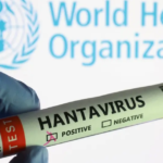 Nuevo caso de hantavirus genera preocupación sanitaria; autoridades mantienen vigilancia epidemiológica