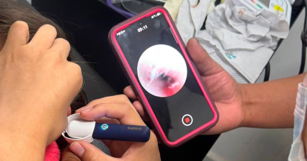 Lo que parecía un simple dolor terminó en una inesperada emergencia: encuentran un ciempiés en el oído de una niña