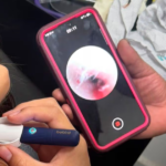 Lo que parecía un simple dolor terminó en una inesperada emergencia: encuentran un ciempiés en el oído de una niña