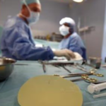 Suben a 146 los casos sospechosos de raro cáncer vinculado a implantes mamarios